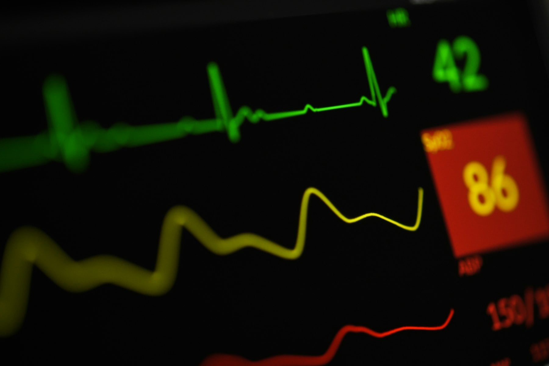 Close-up of a bedside monitor showing an ECG trace, oxygen saturation and blood pressure
